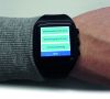 Smartwatch mit integriertem Mobilfunkchip